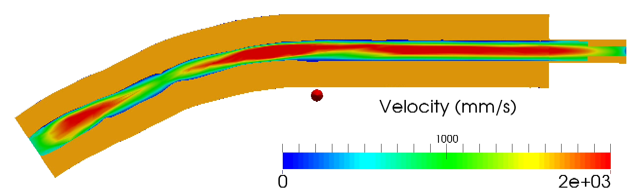 Arter Deadflow Artery Wall under Blood Flow – Solidity